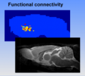 mri-functional_connectivity.png