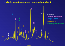 Spettro NMR ad alta risoluzione di metaboliti