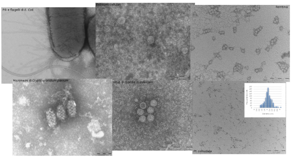 Esempi di applicazione della tecnica del contrasto negativo in microscopia elettronica