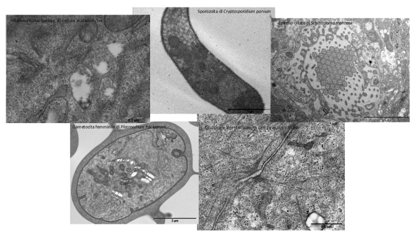 Examples of application of embedding methods in electron microscopy