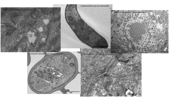 Examples of application of embedding methods in electron microscopy