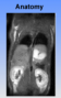 aree:nmr:mri:gallery:mri-anatomy.png