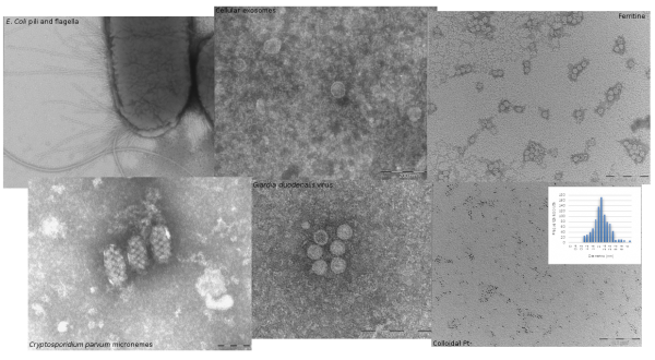 Examples of application of the negative staining technique in electron microscopy