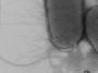 aree:microscopia:elettronica:contrasto_negativo:01-pili_e_flagelli_di_e_coli.jpeg