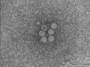 aree:microscopia:elettronica:contrasto_negativo:05-virus_di_giardia_duodenalis.jpeg