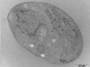 aree:microscopia:elettronica:immunolocalizzazione_di_antigeni:05-proteina_delle_roptrie_di_t_gondii.jpeg