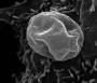 en:aree:microscopia:elettronica:analisi_al_sem:05-citoaderenza_di_plasmodium_falciparum.jpeg