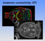 aree:nmr:mri:gallery:mri-anatomic_connectivity.png